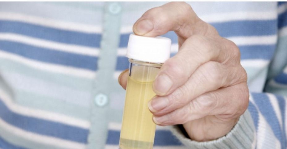Quelles sont les causes de l’infection urinaire ?